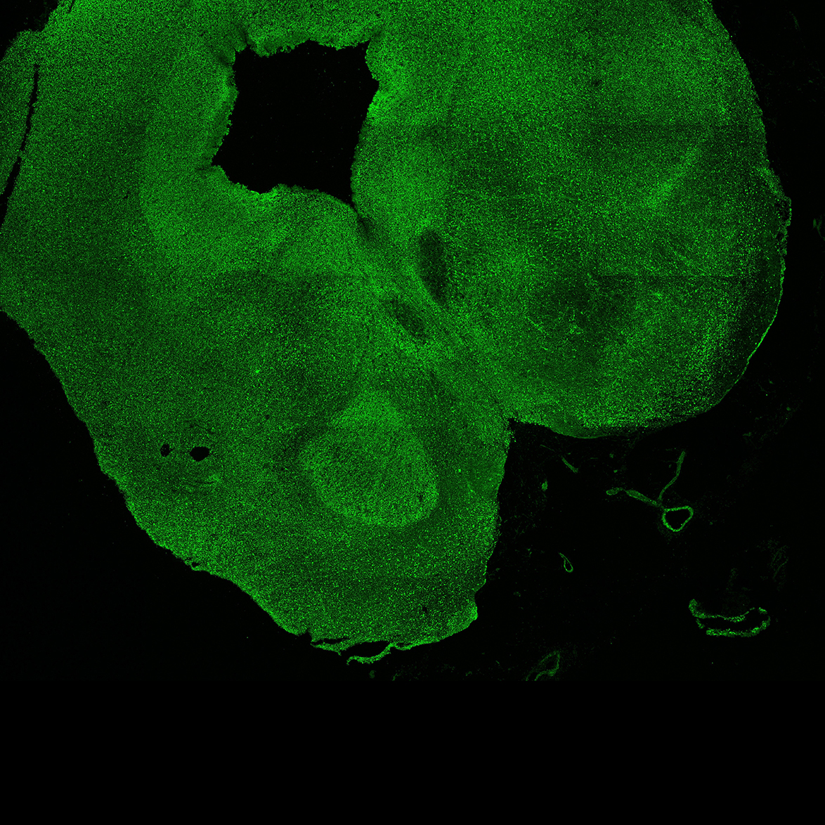 Human foetal midbrain